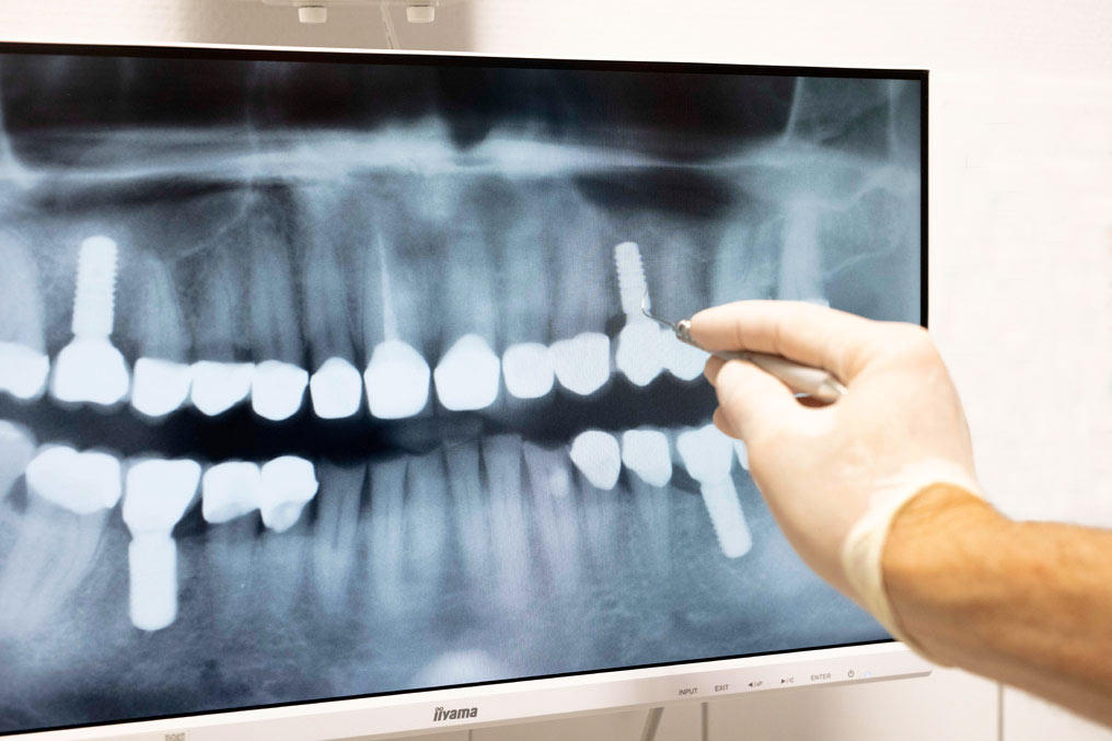 Zahnarztpraxis Reppel: Röntgenbild